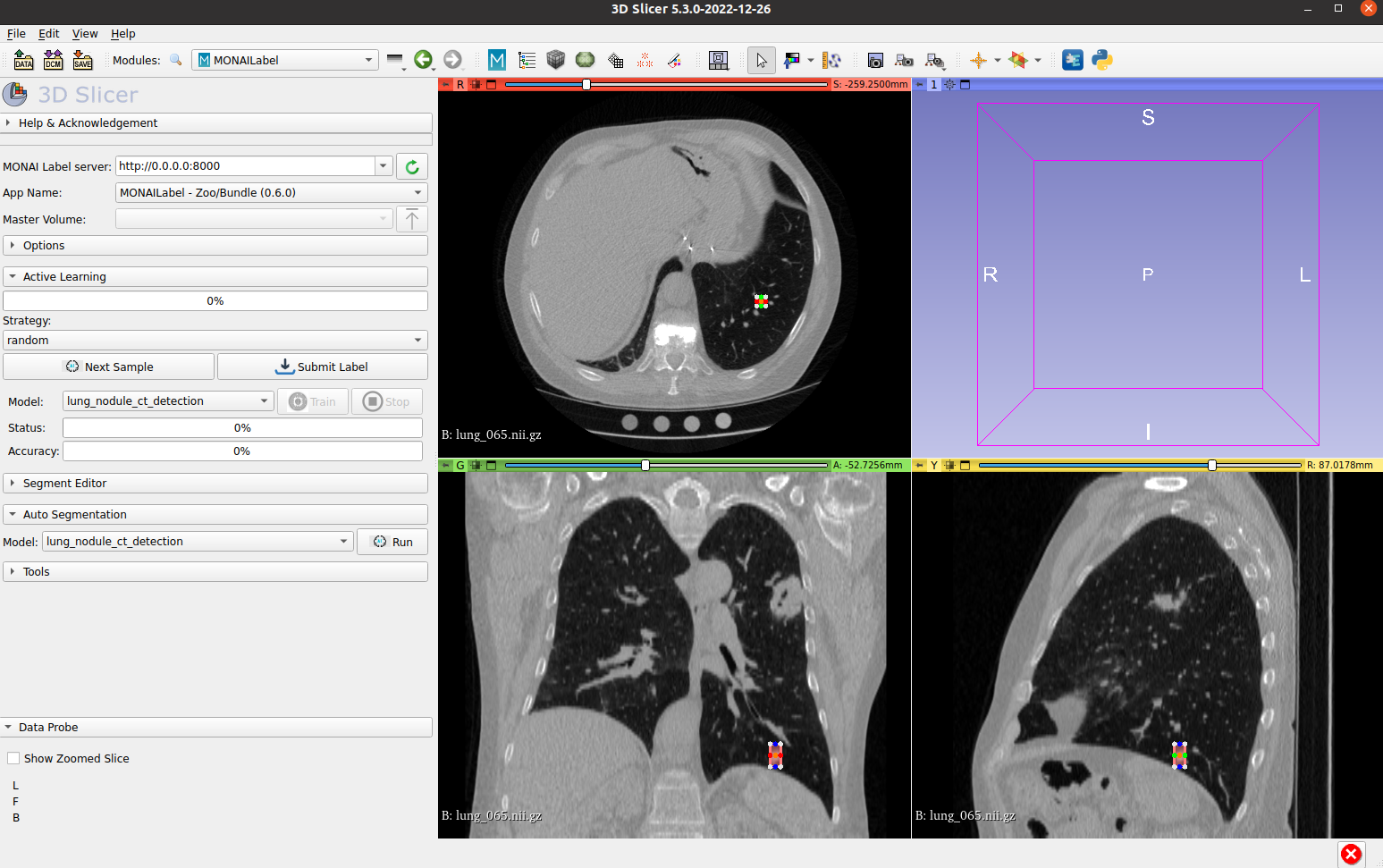 MONAI Label Detection Interface